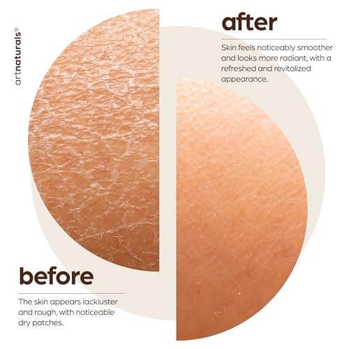 ArtNaturals Arabica Coffee Body Scrub - Exfoliating Moisturizer for Skin, Cellulite & Aging - 20 oz