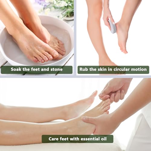 4-Pack Natural Pumice Stone Set for Feet & Hands - Callus Remover