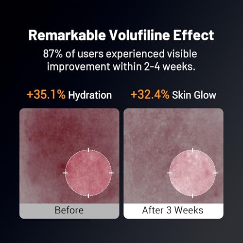 Volufiline Anti-Aging Serum for Face - 5% Volufiline & 40% Beta Glucan