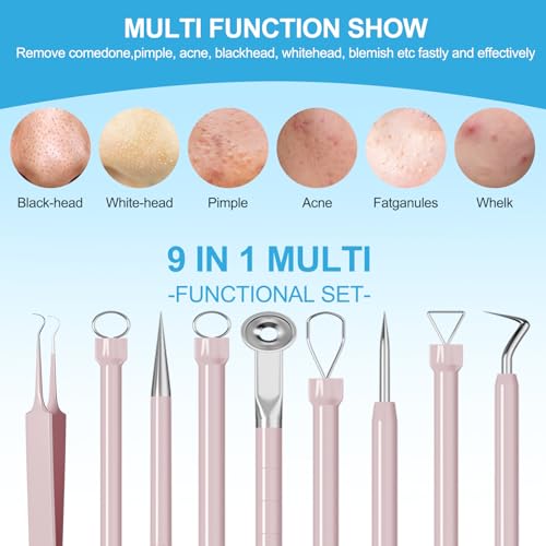 5-Piece Blackhead Remover Tool Kit - Professional Stainless Steel