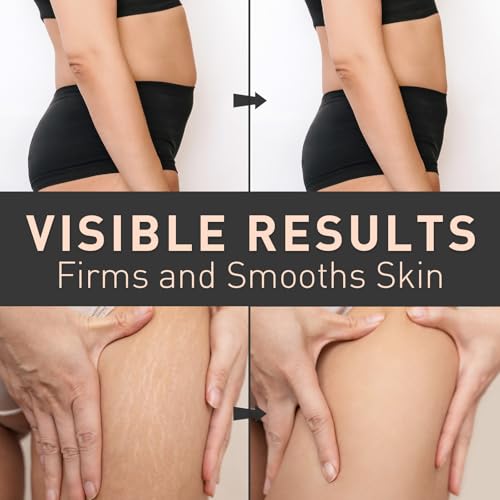 Enaskin Naturals Orange Belly Firming Cream - Skin Tightening & Cellulite Reduction 100 mL