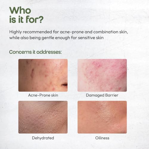 Suvechha Organic Face Moisturizer for Acne-Prone & Sensitive Skin