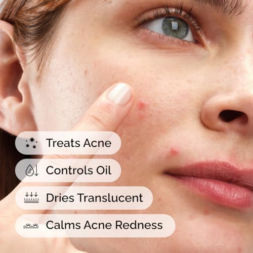 The Ordinary Sulfur 10% Powder-to-Cream Acne Spot Treatment 0.18 Oz - Fast Acne Relief
