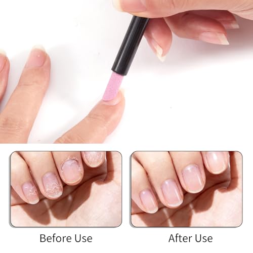 SILPECWEE 4 Pieces Pumice Stone Nail Files & Cuticle Removers - Professional Nail Art Tools