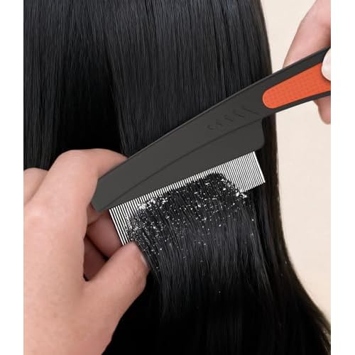 Self-Cleaning Dandruff Comb 2-Pack Set, Hollow Teeth Button-Release Scalp Detox, Fine Tooth 0.5mm & 2mm for Nits Buildup Removal, Women Men Kids, Stainless Steel Ergonomic Anti-Slip Hair Care Tool