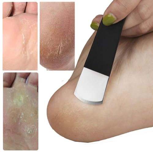 Callus Remover Foot Tool Kit with 10 Blades & Pedicure Tools - Safe & Effective