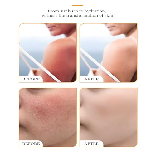 SPF 50 Beef Tallow Sunscreen for Face & Body - Natural Moisturizing Sun Block
