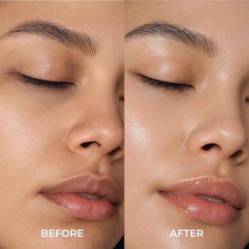 24K Gold Eye Patches for Puffy Eyes and Dark Circles, Luxury