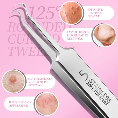 Teenitor Blackhead Remover Tool Kit – 4 Stainless Steel Extractors