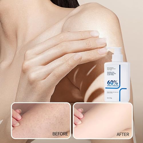 NIZENTA Urea Cream 60% Body Lotion 10.58 Oz (Pack of 2) - Non-Greasy Moisturizer for Dry Skin