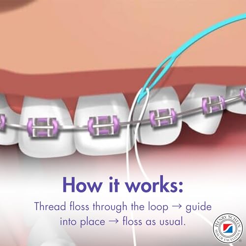 Dental Floss Threaders for Bridges, Implants & Braces - 100 Ct