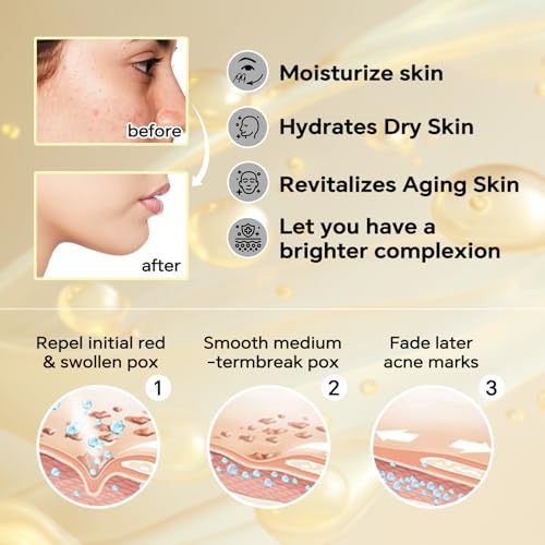 Sokgo Snail Mucin Cream - Hydrating Moisturizer for All Skin Types, 1 Pack
