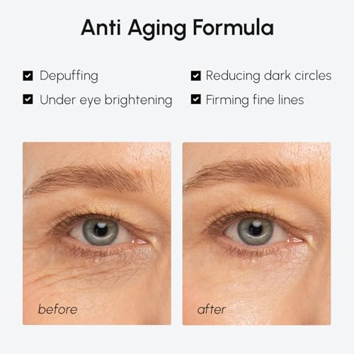 MAREE Under Eye Balm Stick Hydrating ? Retinol Caffeine Under Eye Brightener Stick for Older Women ? Collagen Undereye Cream for Dark Circles & Wrinkles ? Skin Care Treatment Moisturizer