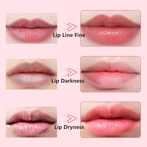 Adofect Pink Collagen Lip Patches - Hydrating Hydrogel Lip Mask for Dry, Wrinkled Lips, 30 Pack
