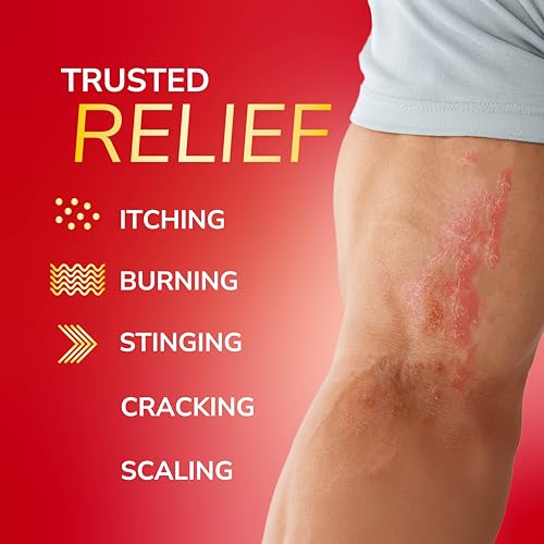 Dr. Scholl's Fungal-X Antifungal Cream for Athlete's Foot Relief - 1 oz