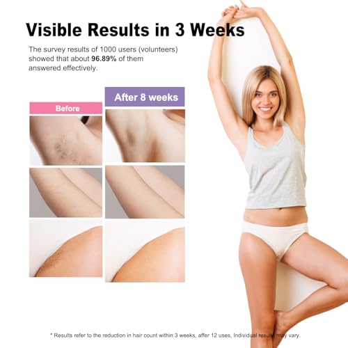 IPL Hair Removal Device, Model: AI08, for Facial Legs Arms Bikini Line