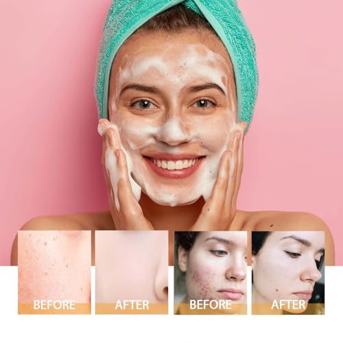 HOYGI Turmeric Face Wash with Brush - 1 Pack, Foaming Facial Cleanser for All Skin Types, 3.38 Fl Oz