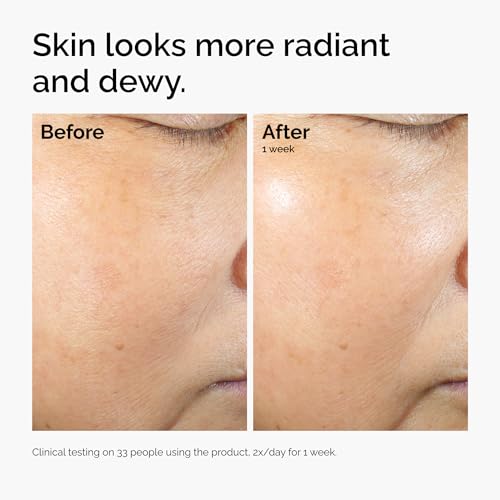 The Ordinary Rice Lipids Moisturizer for Dry Skin - Soothing Hydration & Barrier Repair