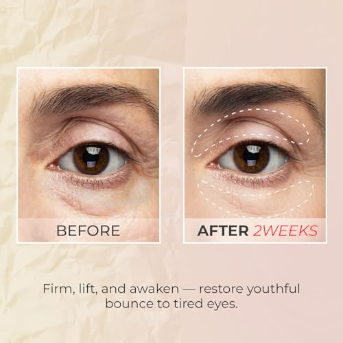 KSBC Look At Me Teen Again Anti-Aging Eye Cream with Peptide & Retinol, 0.84 fl oz