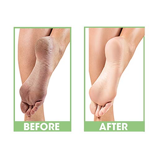 ProLinc Dry Heel Eliminator - 4 Fl Oz, Hydrating Foot Lotion for Dry Cracked Heels, Made in USA