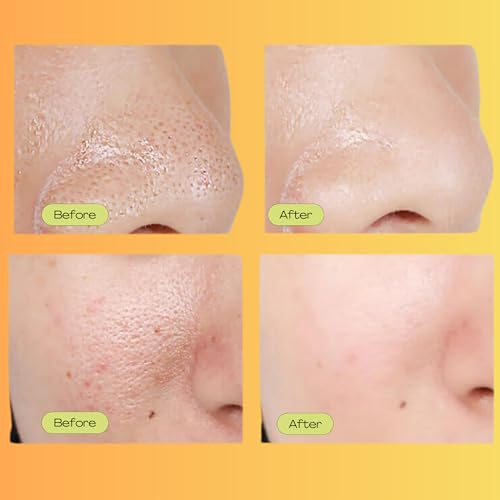 Luelle Pore Minimizer Serum for Face - Oil Control & Skin Refining