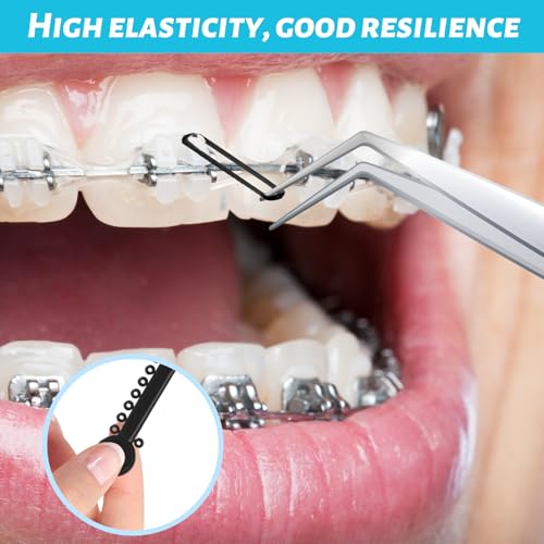 Orthodontic Rubber Bands for Braces - 1040 Pcs Black Ligature Ties, Elastic O-Rings