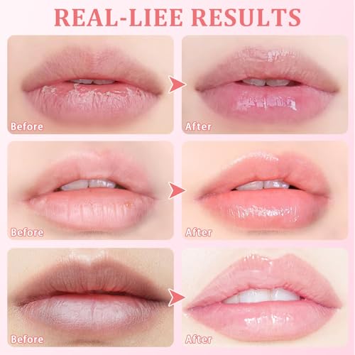 5 Pcs Bee Lip Balm Set - Honey, Strawberry, Watermelon, Apple Lime, Cherry - Moisturizing Overnight Lip Mask