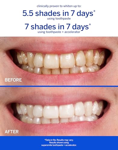 Supersmile Original Mint Whitening Toothpaste - 1.4 oz Travel Size
