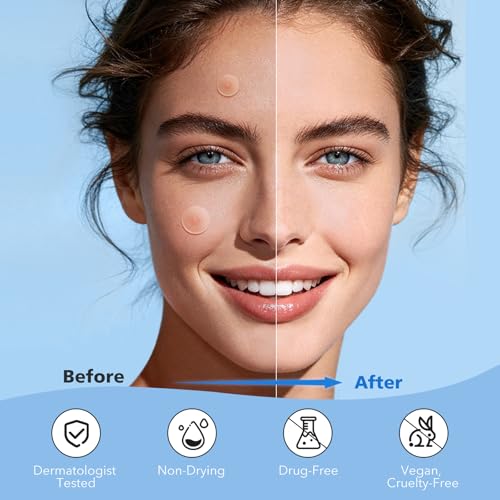 QUSTERE Hydrocolloid Pimple Patches for Face - 800 Count, 4 Sizes