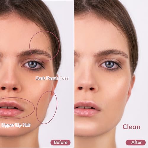 Pelcas Electric Dermaplaning Tool Kit for Face with LED Light - Painless Exfoliation