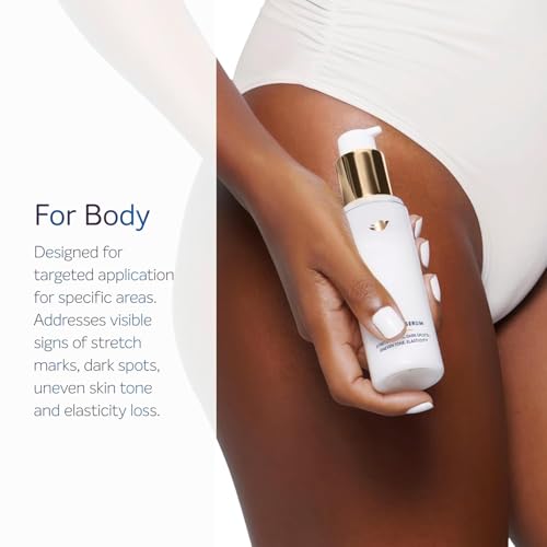 Dove Targeted Body Serum for Stretch Marks & Dark Spots - 3.2oz