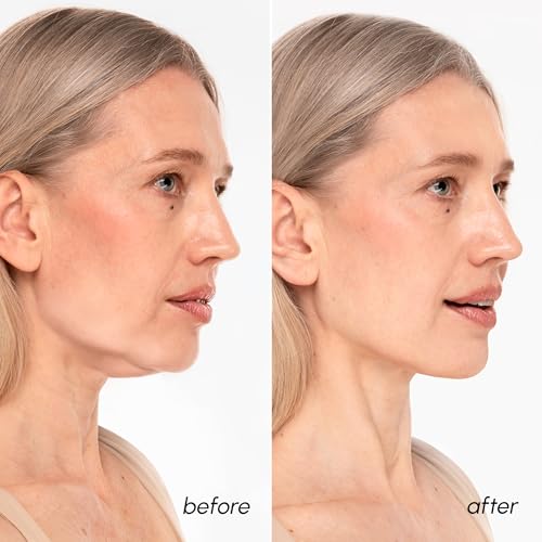 MAREE V Line Lifting Mask with 24K Gold ? Deep Collagen Face Mask for Women ? Jawline Shaper Mask with Retinol & Hyaluronic Acid ? Neck Tightening & Firming - Double Chin Strap for Face Lift