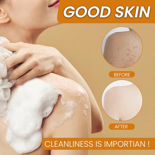 Derperzi Turmeric Soap & Foaming Face Wash Set with Exfoliating Brush