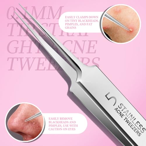 Teenitor Blackhead Remover Tool Kit – 4 Stainless Steel Extractors