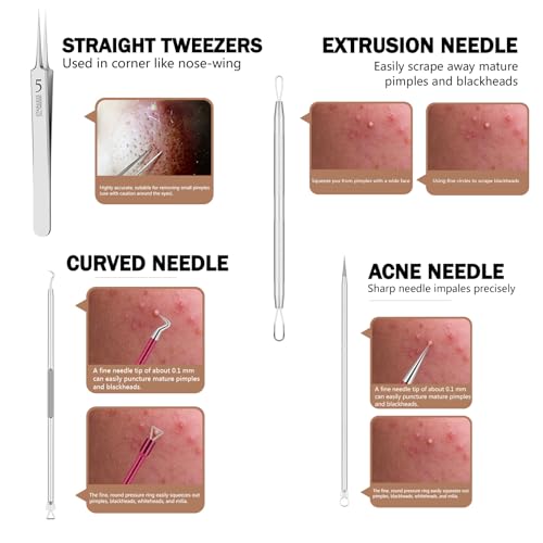 10-Piece Blackhead Remover Tool Kit with Storage Case