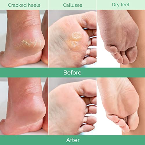 Plantifique Peach Foot Peeling Mask - Exfoliating for Soft Feet