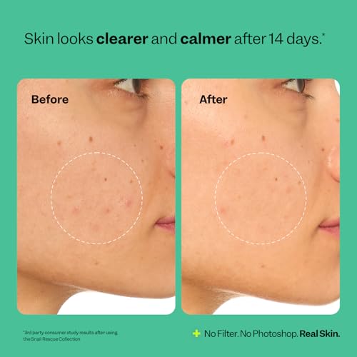 Peach Slices Snail Rescue Jelly Mask - 95% Snail Mucin, 3.38 oz