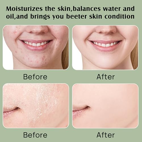 YBHMO Organic Beef Tallow Moisturizer with Raw Honey - 4oz