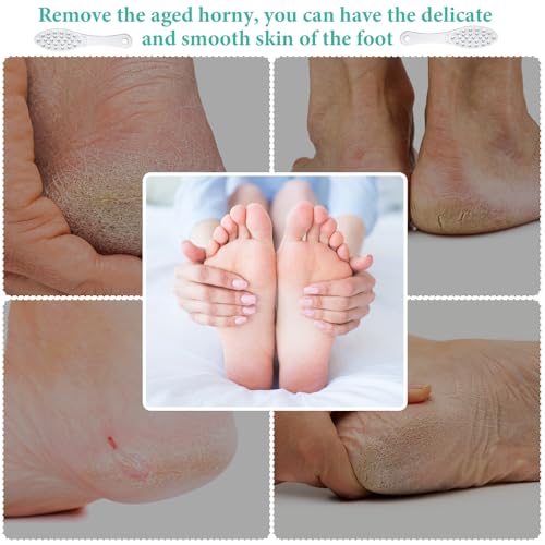 Jutom 4-Piece Stainless Steel Foot File - Double-Sided Callus Remover