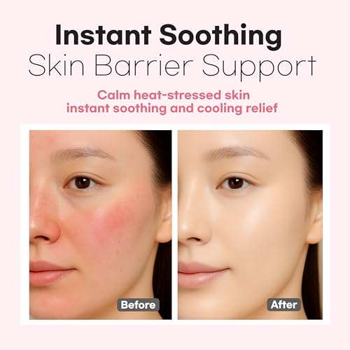 Aurtier Intensive Soothing Collagen Jelly Mist 3.38 Fl Oz - Deep Hydration & Glow