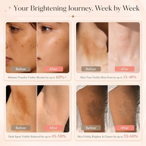 Skin Bleaching Cream for Dark Spots, Skin Lightening Whitening Brightening Cream, Dark Spot Remover for Body Face Intimate Areas, Underarm, Bikini Area, Inner Thigh, Knees and Elbows,100ml | Dark Spot Care