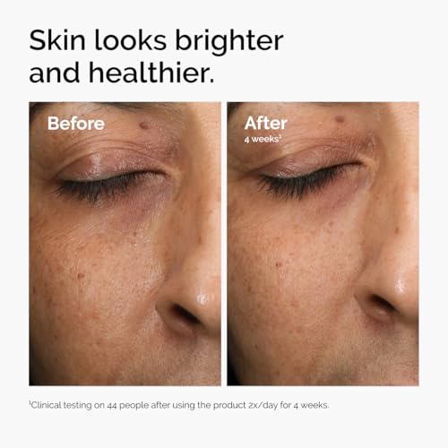 The Ordinary Vitamin C Radiance Serum - Brightening Face Serum for Healthy Glow, 1 Fl Oz