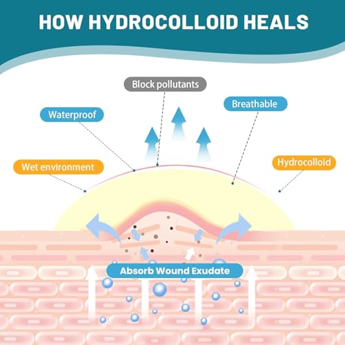 Hydrocolloid Pimple Patch Roll - Customizable Acne Treatment