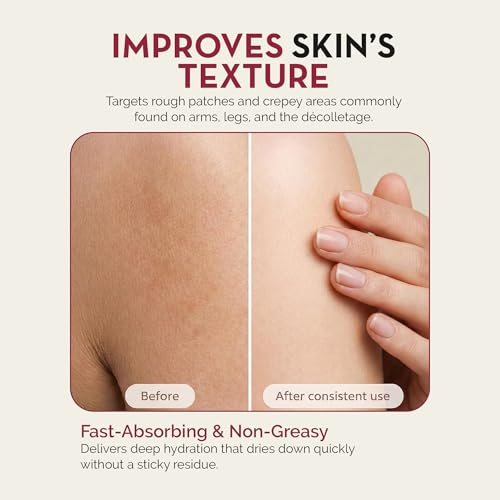 Rosen Apothecary Retinol Body Lotion 16oz – Anti-Aging Firming Moisturizer for Crepey Skin