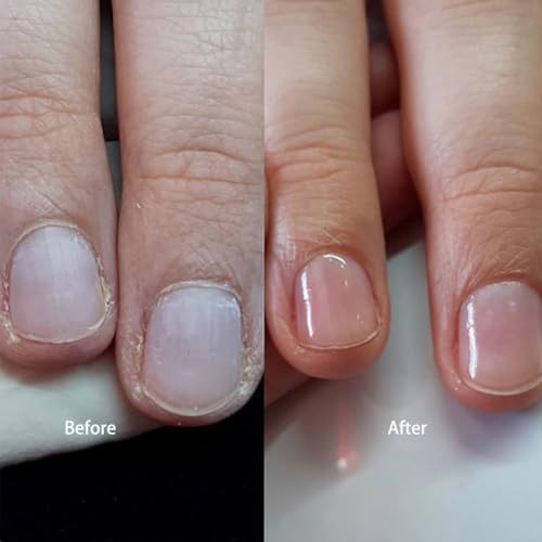 Tinovo Uno Strong Rubber Base Gel - Long Lasting Clear Nail Coat