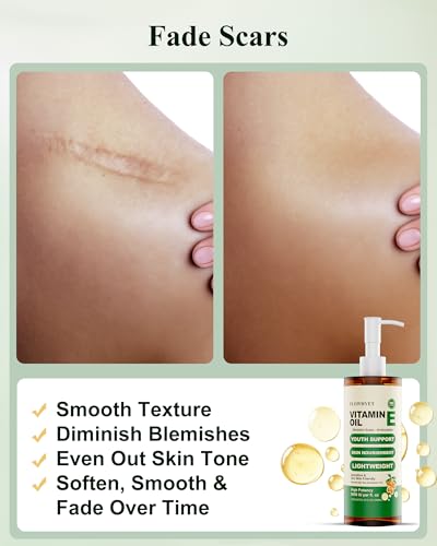 10 Fl Oz Organic Vitamin E Oil for Skin, Scars & Hair - Unscented