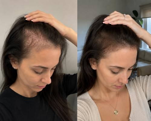 Rosemary & Biotin Shampoo for Thinning Hair - Thicker, Fuller Hair