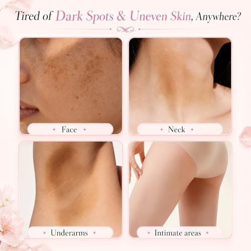 Skin Bleaching Cream for Dark Spots, Skin Lightening Whitening Brightening Cream, Dark Spot Remover for Body Face Intimate Areas, Underarm, Bikini Area, Inner Thigh, Knees and Elbows,100ml | Dark Spot Care