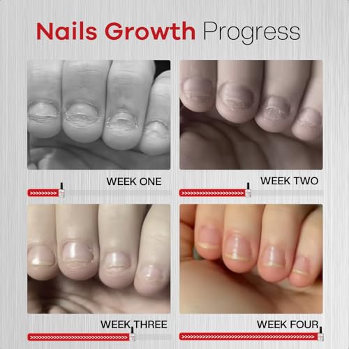 Glamonade 2-in-1 Nail Biting Treatment Kit with Bitter Polish & File