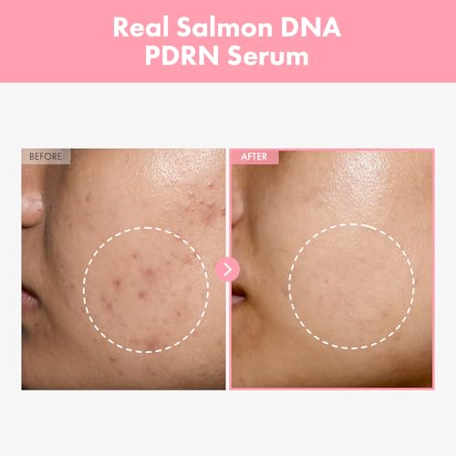 TOSOWOONG Pink Peptide 12 PDRN Serum for Radiant Skin